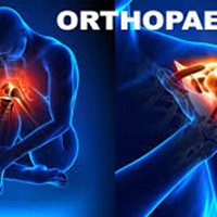 Orthopaedics